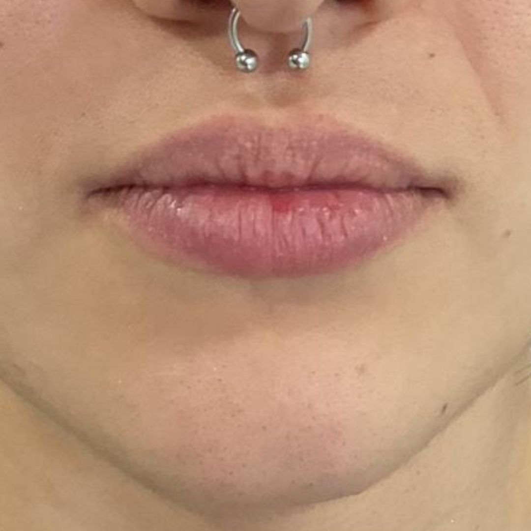 hidratación-de-labios-huelva