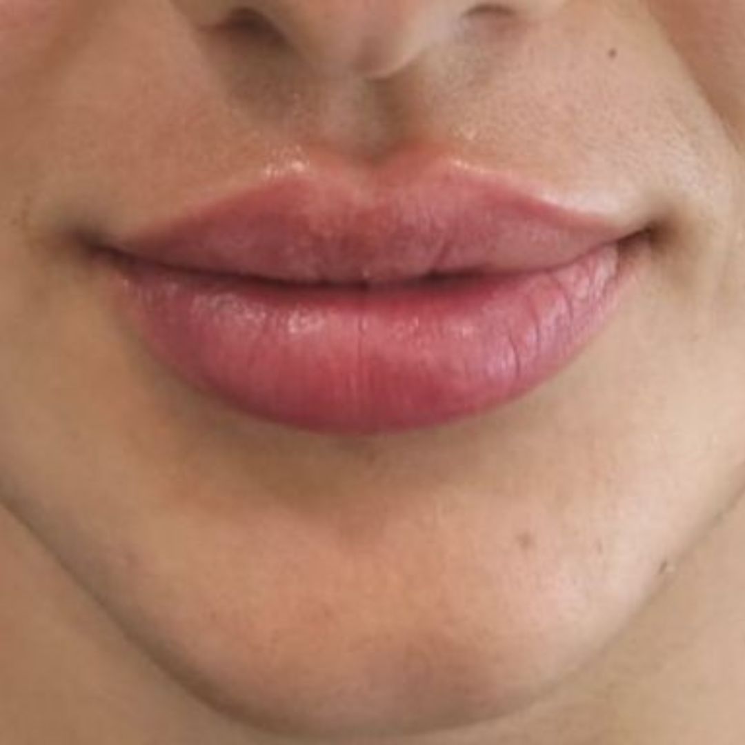 hidratación-de-labios-huelva
